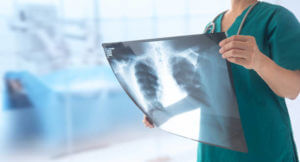 doctor radiologist looking lung x-ray film of patient at hospital.